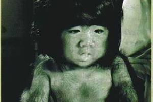 中国第一毛孩，几度想自杀，如今成功逆袭