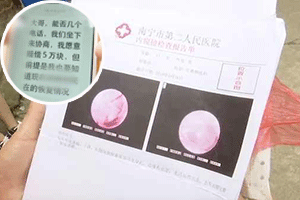 老师把小学生打成右耳鼓膜穿孔 答应赔偿又反悔