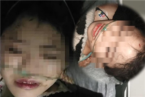 云南15岁失联少女酒店坠楼重伤 称被逼卖淫