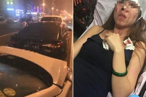 女模特乘快车遇车祸毁容 滴滴:将封号赔偿