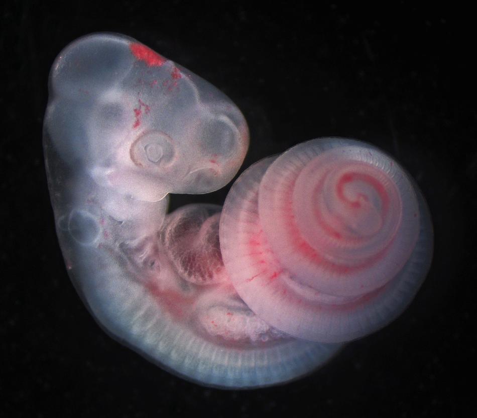 组别:显微成像亚军获奖者:tyler square获奖作品:《the spiralled