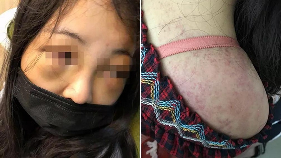 17岁女生因打呼噜 被8同学从上铺拖下群殴