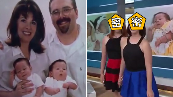连体双胞胎分离手术后 分享奇妙心灵感性