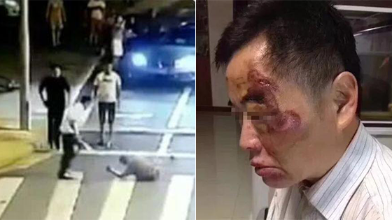 昆山砍人“骑车男”哥哥 ：不反击他就死