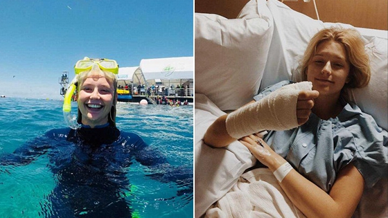 20岁少女爱咬美甲竟患癌症 三次手术无奈截肢