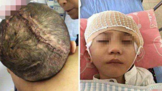 该！虐童案一审宣判 狠心继母被判16年