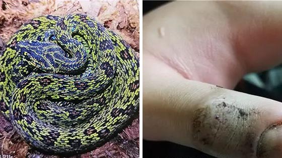 少年养毒蛇当宠物，掰开毒牙给蛇上药被咬