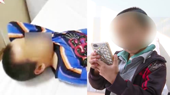 9岁男孩玩手机患歪脖子病 躺下难爬起