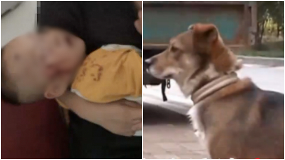 男童遭疯狗咬毁容 家属索赔5万遭物业拒绝