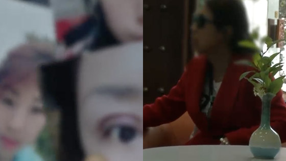 女子花5000元开眼角割双眼皮 结果睡觉闭不上眼