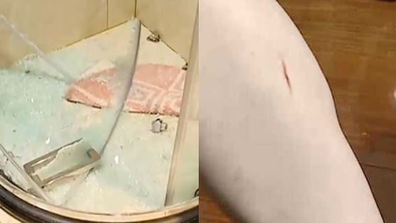 淋浴房突然炸裂 女子澡没洗成全身被划伤