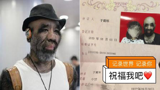 “中国第一毛孩”于震寰结婚了