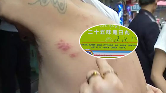 男子看皮肤病却被开妇科药？医生：中药得辩证看