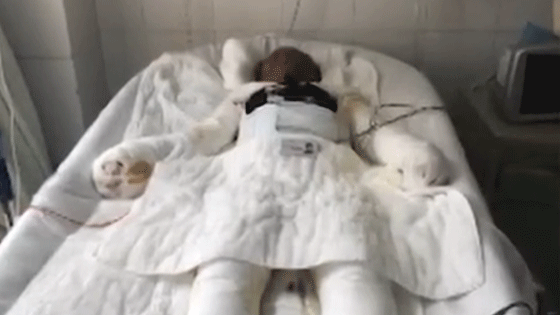 煤气罐爆炸母亲全身70%烧伤 儿子为省钱睡医院走廊5天瘦4斤