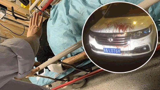 滴滴司机深夜刀捅乘客 平台显示是