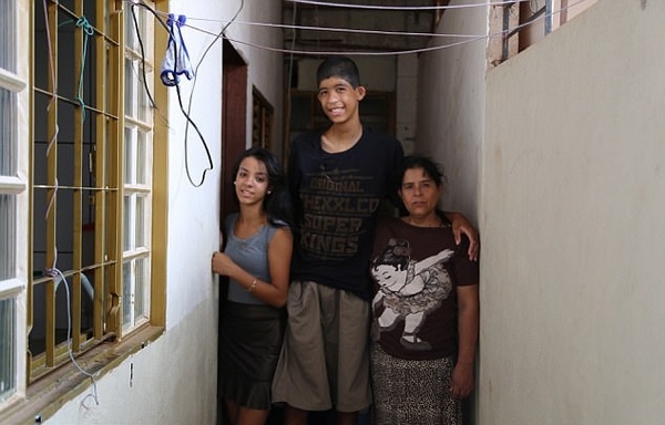 12岁男孩患巨人症身高2.3米 冒险手术治疗