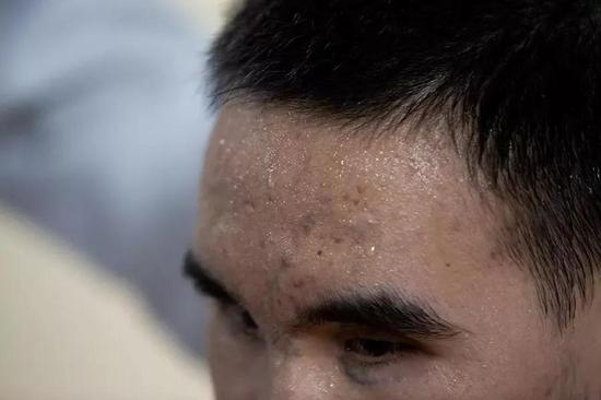 △杜富国体能康复训练后,满头大汗。