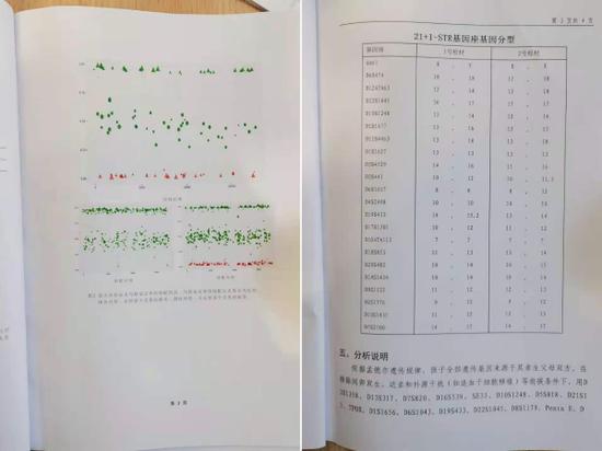 Dna亲子鉴定师 有人看完报告回家把妻子腿打断 手机新浪网 Dna亲子鉴定师 有人看完报告回家把妻子腿打断 手机新浪网