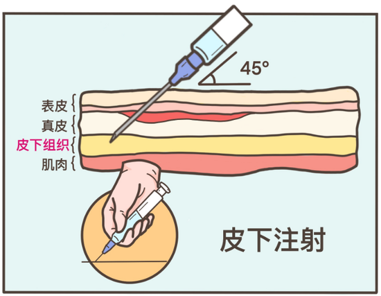 打新冠疫苗前有件事一定要告诉你