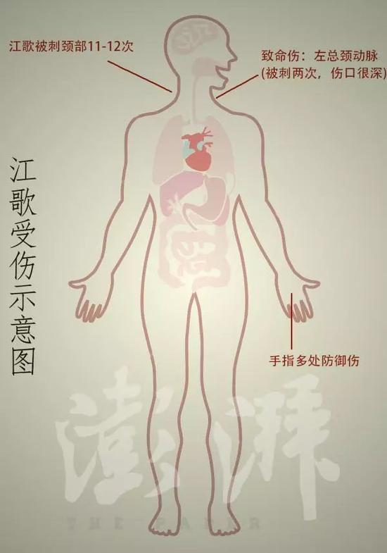 江歌案庭审:在致命一刀后倒下