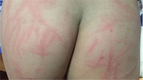 气坏的爸爸把儿子屁股打开花