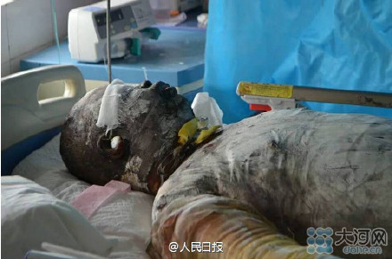 救火英雄王锋去世 曾三闯火海救人