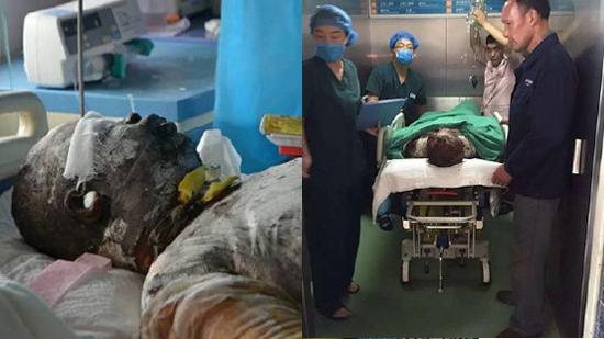 救火英雄王锋去世 曾三闯火海救人