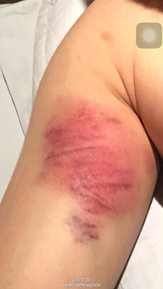 狂用替身?制片人证杨洋敬业：吊威亚受伤