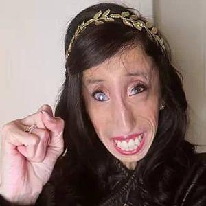 一天吃60顿饭却暴瘦 世界最丑女人因演讲走红