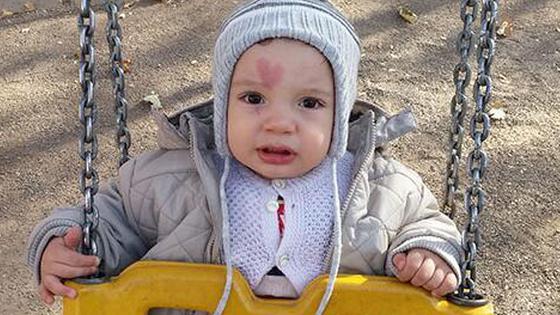 小男孩出生自带心形胎记