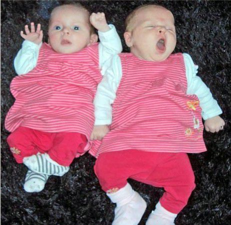 英国出生一对罕见双胞胎体重相差1.2公斤