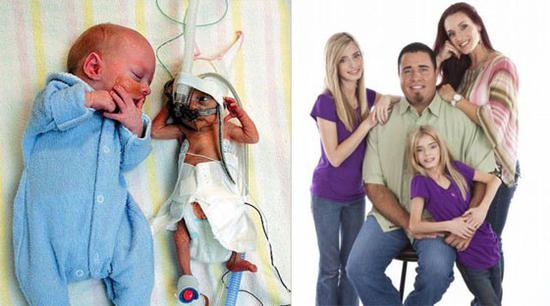 盘点全球最不可思议的双胞胎