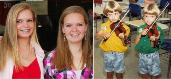 Erin Hatfield和妹妹Ashley Hatfield虽然源自母亲的同一个卵子，按理来说，她们应该拥有几乎一样的身体和性格特征。然而，一人的左脸和另一人的右脸特征一样；一人好动一人好静；一人习惯用右手，另一人习惯用左手。