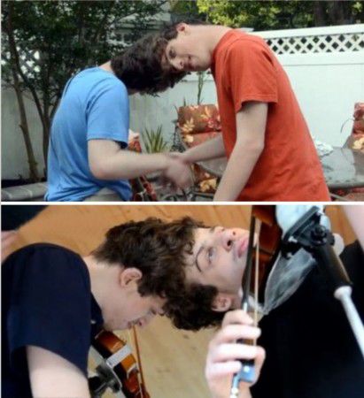 2011年6月，美国宾夕法尼亚州南泽西的双胞胎兄弟每天形影不离，但是除了借助镜子以外，他们从没见过对方的脸。据悉，他们是一对非常罕见的同卵双胞胎，两个人头部连在一起，一个脸向前，一个脸向后。