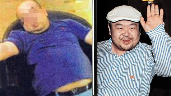 疑似金正男遇袭后照片曝光