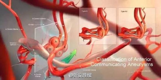 医生周舒扬和他的医学插画