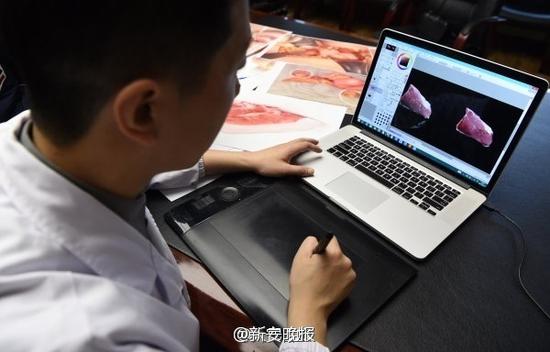 医生周舒扬和他的医学插画