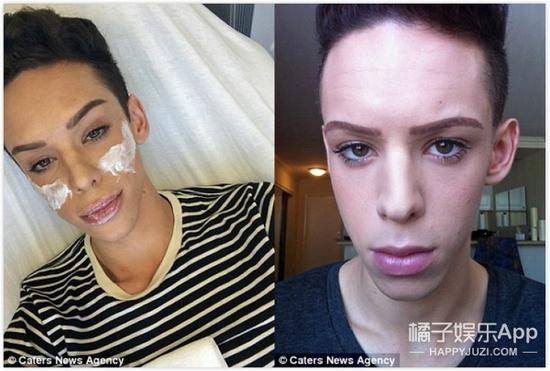 经历100多次手术 只为变成无性别人