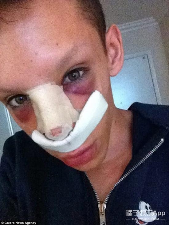 经历100多次手术 只为变成无性别人