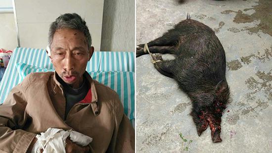 上山采茶被猪獾咬伤 竟欲吃獾肉解气
