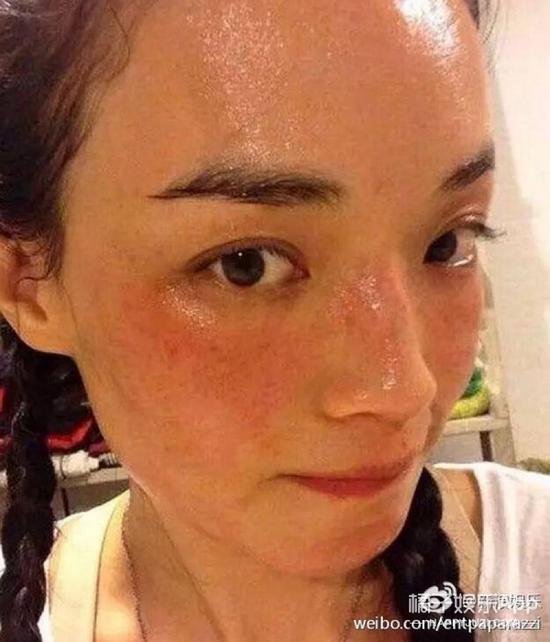 舒淇女神的自拍一向是放飞自我型，连过敏照都敢晒啊.....