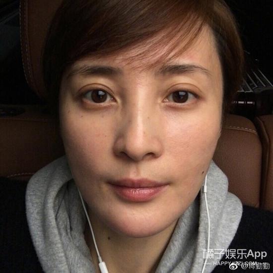 前段时间因为过敏被拍而上了热搜的蒋勤勤，其实皮肤还是很好的