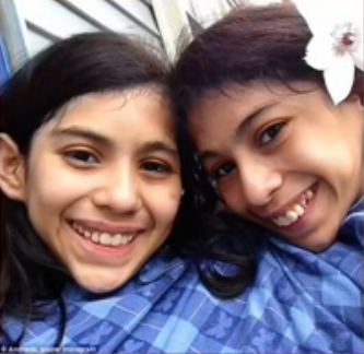 16岁连体姐妹拒做分离手术