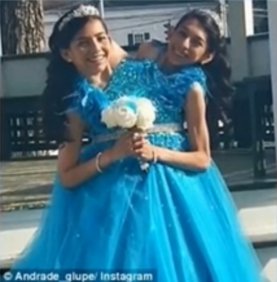 16岁连体姐妹拒做分离手术