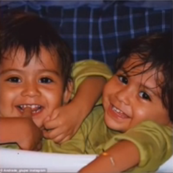 16岁连体姐妹拒做分离手术