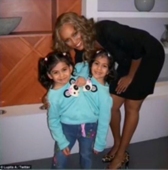 16岁连体姐妹拒做分离手术