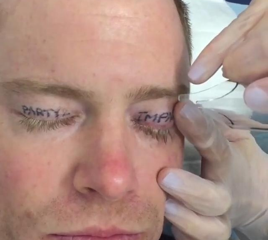 同样的，这哥们儿也在一场狂欢后，在酒后神志不清的情况下，强烈要求纹身师在眼皮上纹身。他纹的是Party2Impact，大意为“向第二次聚会冲击”，也许觉得那次狂欢没有尽兴，清醒后的他懊悔不迭，只好满大街去找能祛除纹身的地方。