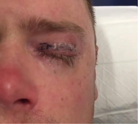 希望这次酒后冲动的惩罚能让他吸取教训。