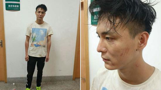 直播夜跑被绑架 网络主播获救时伤痕累累
