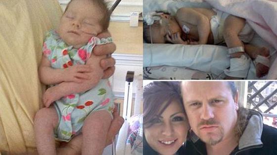 生来就和常人不同 这个闪电宝宝太可爱